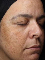 Image of face before using product